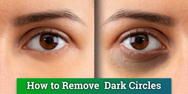 How to remove dark circle